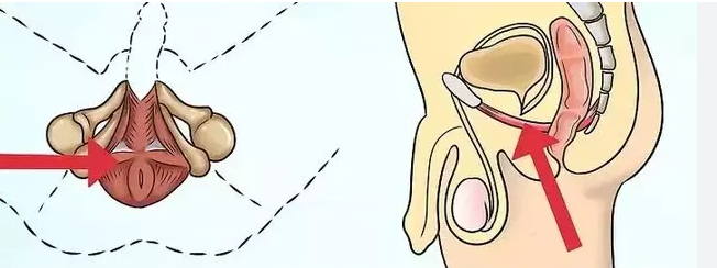 让丁丁变硬较好的方法：锻炼PC肌缩略图